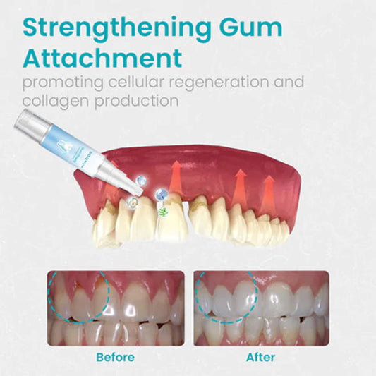 Gum Therapy Gel